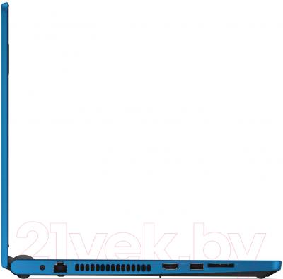 Ноутбук Dell Inspiron 15 (5555-9198)