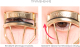 Миниатюра изображения товара Керлер Missha Professional Eyelash Curler