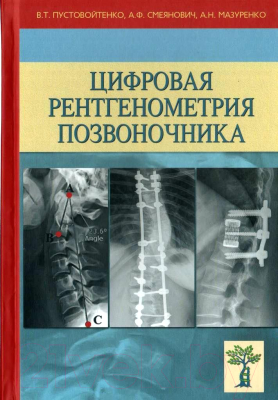 

Книга Издательство Беларусь, Цифровая рентгенометрия позвоночника