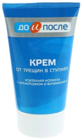 

Крем для ног, От трещин в ступнях