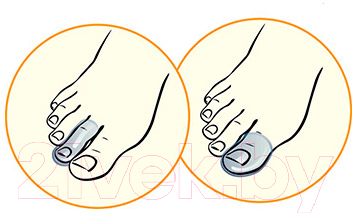 Протектор для пальца стопы Talus 04С (р.1)