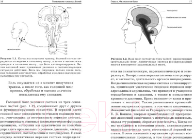 Книга Попурри Как остановить головную боль (Бартли Д.)