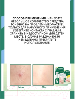Гель для лица Mentholatum Acnes Точечный для проблемной кожи (18г)