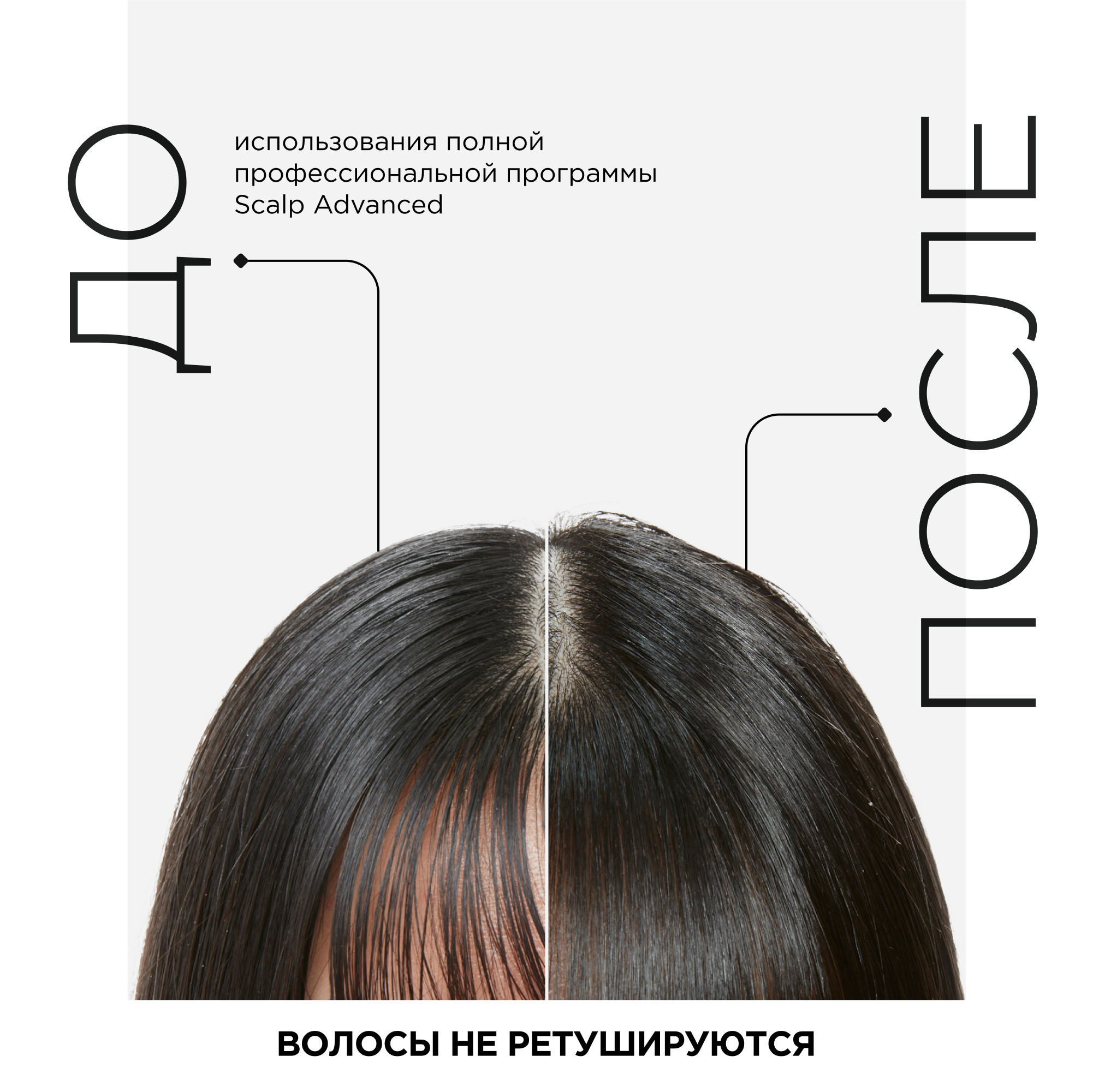 Кондиционер для волос L'Oreal Professionnel Scalp Advanced