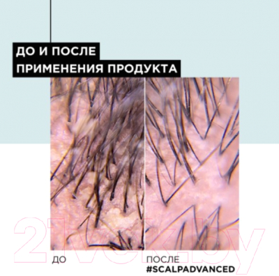 Шампунь для волос L'Oreal Professionnel Scalp Advanced Anti-Dandruff (300мл)