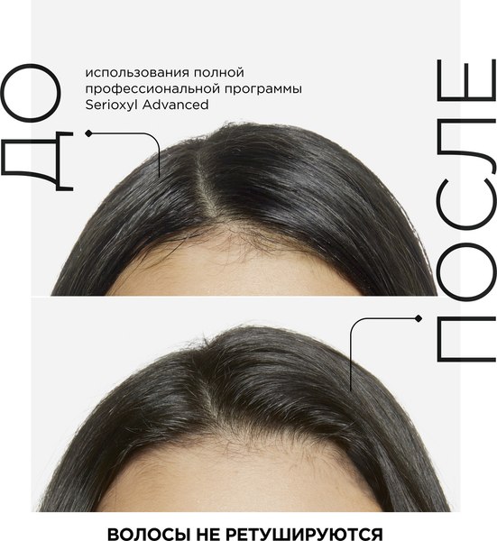 Сыворотка для волос L'Oreal Professionnel Serioxyl Density (90мл)