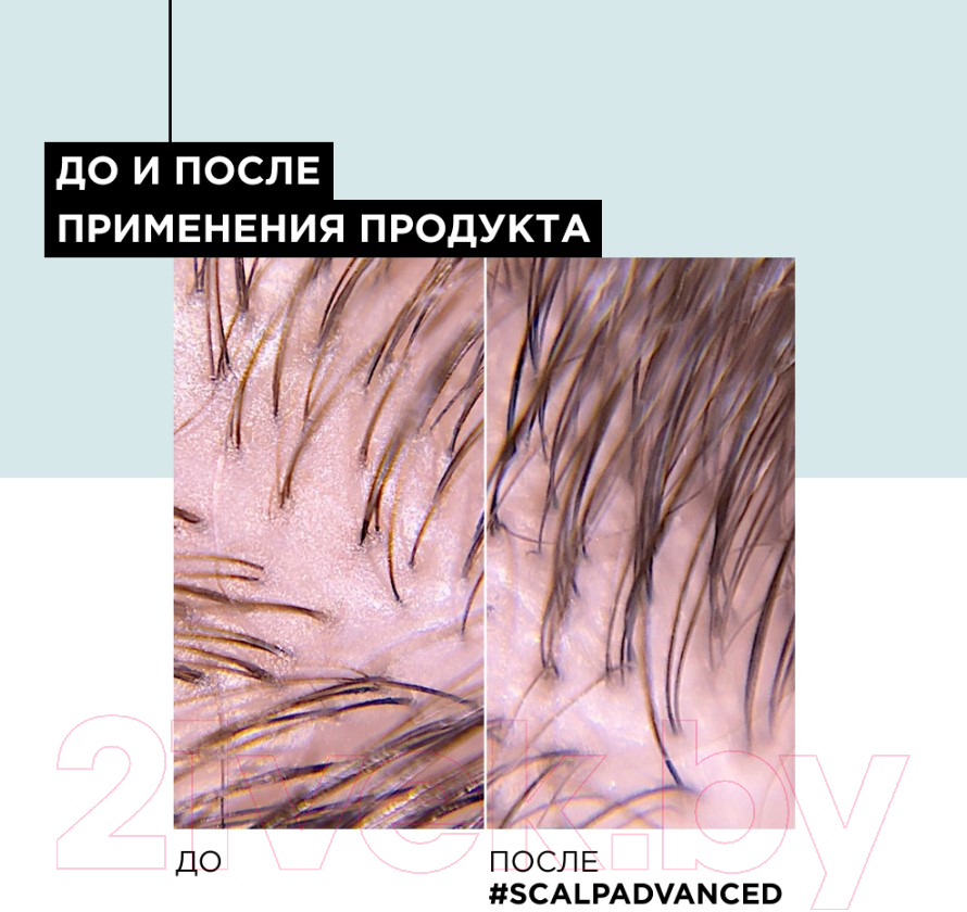 Шампунь для волос L'Oreal Professionnel Scalp A-Oily