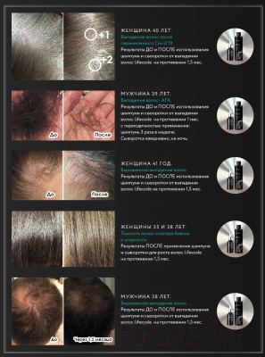 Шампунь для волос LifeCode Против выпадения и для роста волос (250мл)