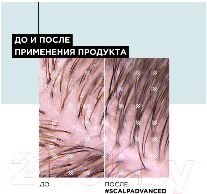 Шампунь для волос L'Oreal Professionnel Serie Expert Scalp Advanced Склонных к жирности