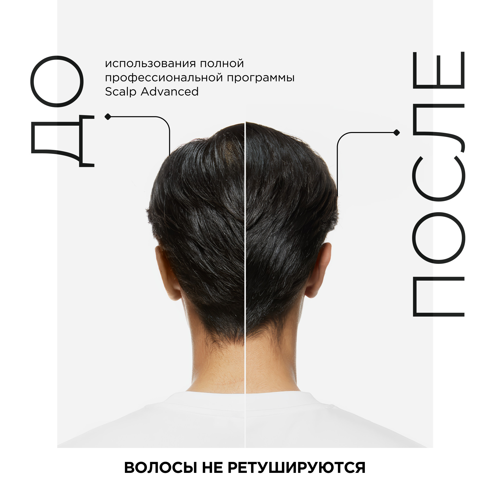 Шампунь для волос L'Oreal Professionnel Serie Expert Scalp Advanced Склонных к жирности (500мл) — фото 6