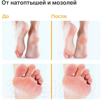 Крем для ног EpilProfi От трещин для очень сухой кожи (100мл)