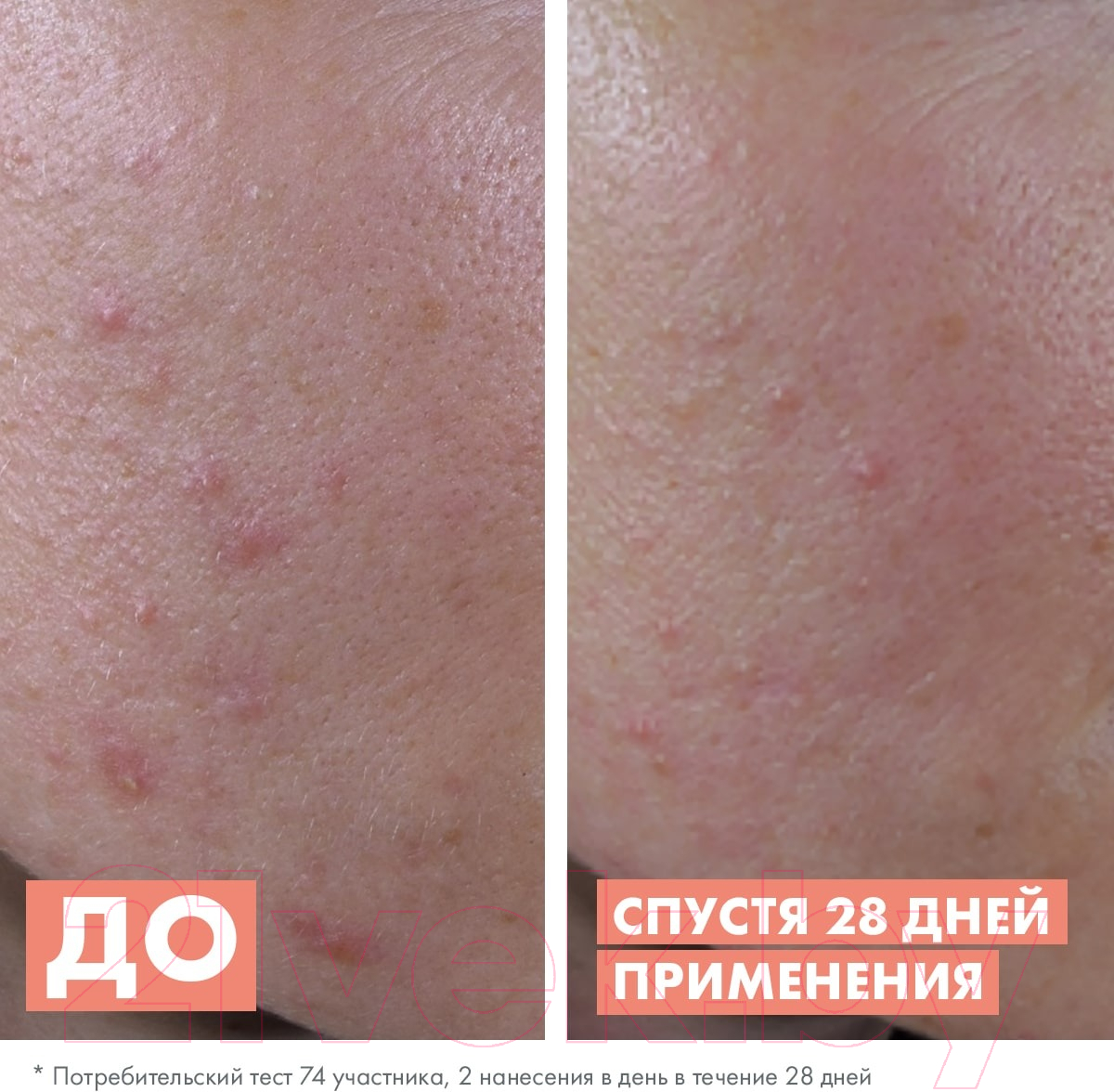 Сыворотка для лица Avene Cleanance AHA Exfoliating Serum Для жирной кожи