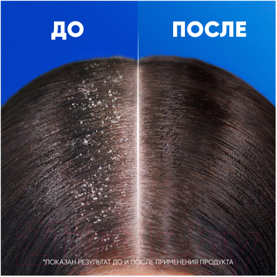 Шампунь для волос Head & Shoulders Ментол против перхоти (800мл)