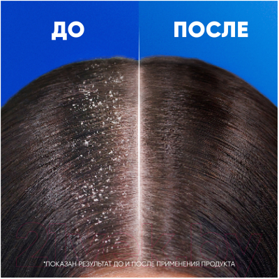 Шампунь для волос Head & Shoulders Комплексный уход (600мл)