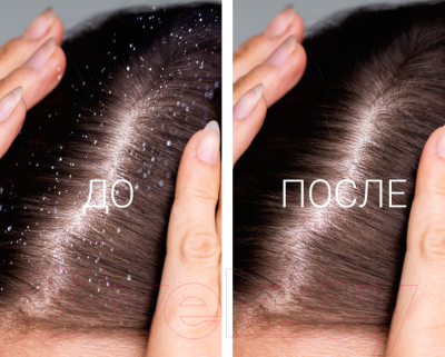Шампунь для волос Anian против перхоти с ментолом, климбазолом и гиалуроновой кислотой (400мл)