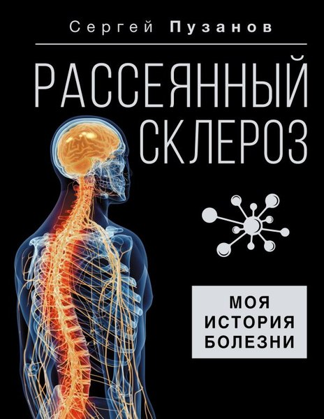 Книга АСТ Рассеянный склероз. Моя история болезни, твердая обложка (Пузанов Сергей)