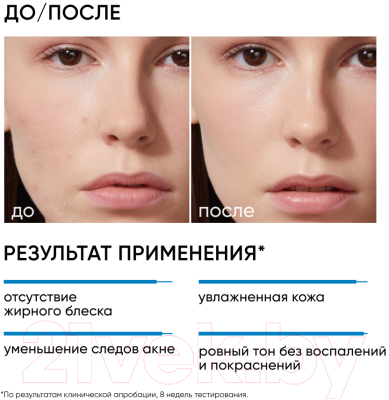 Крем для лица Icon Skin Moist & Heal Anti-Acne (50мл)