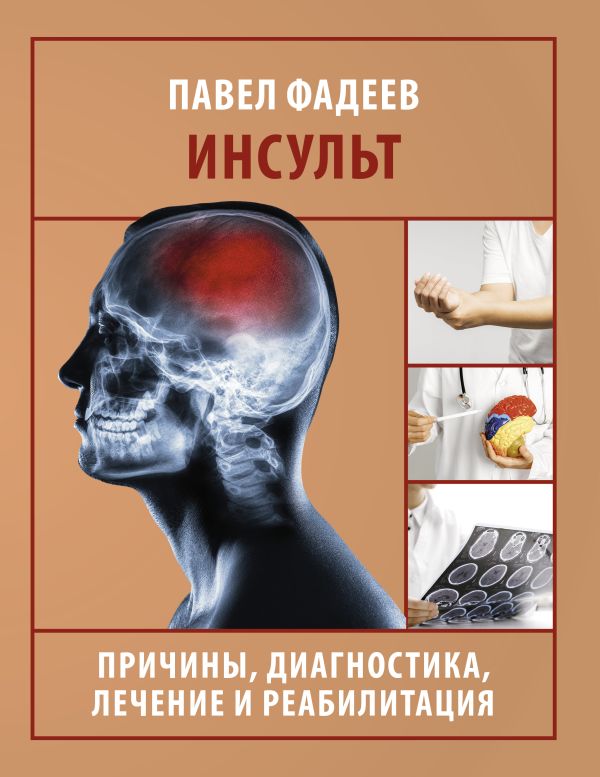 Нехудожественная книга АСТ Инсульт. Причины, диагностика, лечение и реабилитация (Фадеев Павел, мягкая обложка )