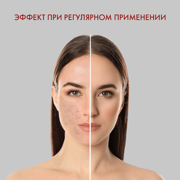 Гель для умывания SkinpHoria Anti-Acne Acid Solution с кислотами (250мл)
