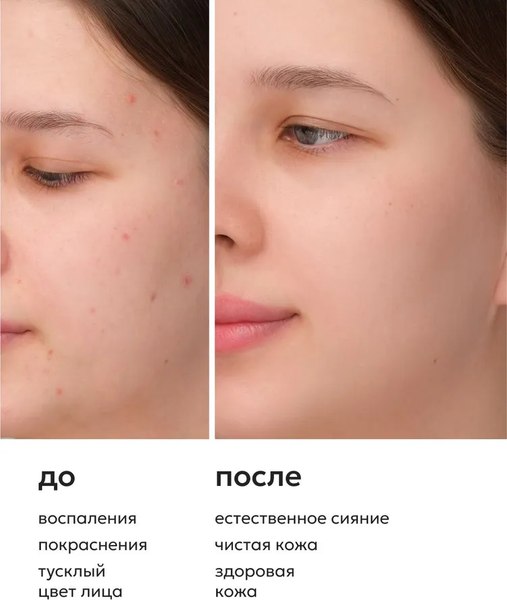 Пенка для умывания Likato Professional для поддержания баланса микробиома кожи (160мл)