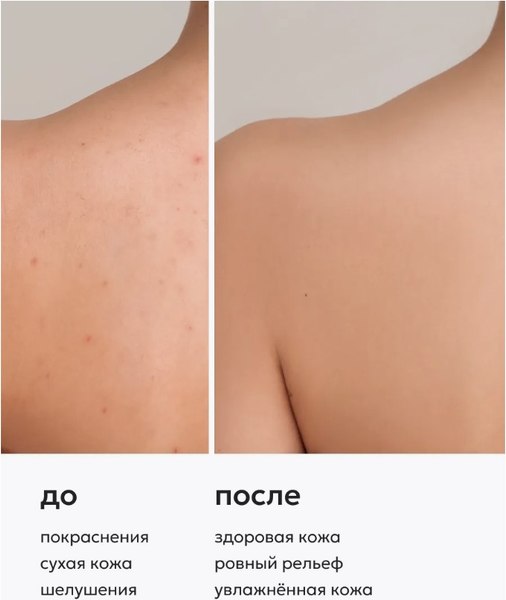 Молочко для тела Likato Professional Acne Control уход за проблемной кожей (250мл)