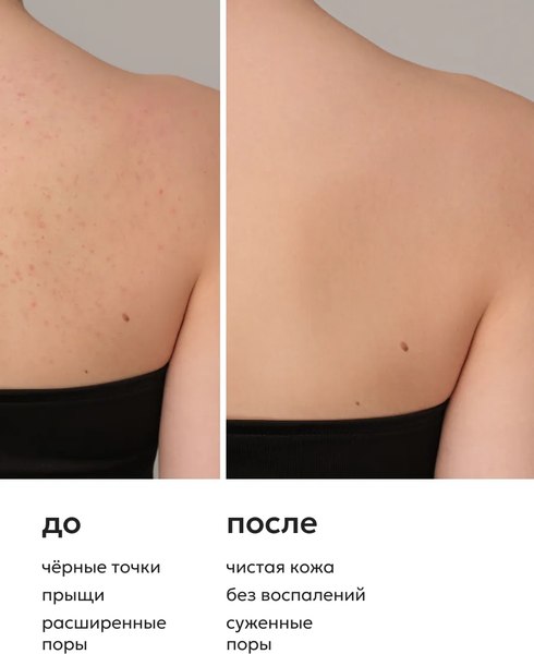 Гель для душа Likato Professional Acne Control от прыщей на теле (250мл)