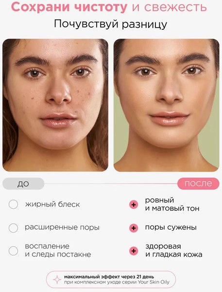 Тоник для лица MIXIT Матирующий с ниацинамидом (500мл)