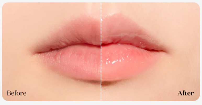 Блеск для губ Vt Cosmetics Reedle Shot Lip Plumper Beginner Плампер с микроиглами (4.3г) — фото 5