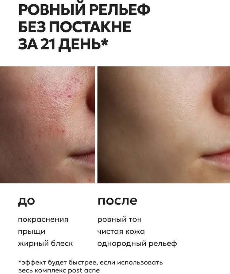 Крем для лица Likato Professional Post Acne Точечный от прыщей и постакне (20мл) — фото 6