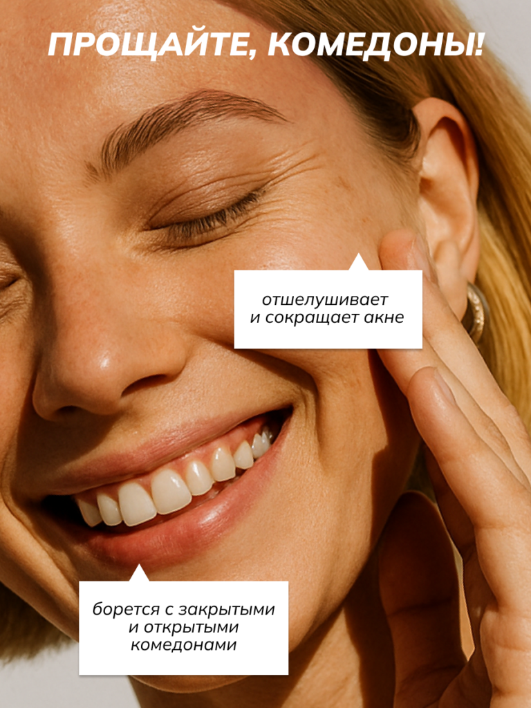 Пилинг для лица Art&Fact Зеленый с азелаиновой кислотой 15%, миндальной кислотой 5% (30мл) — фото 5