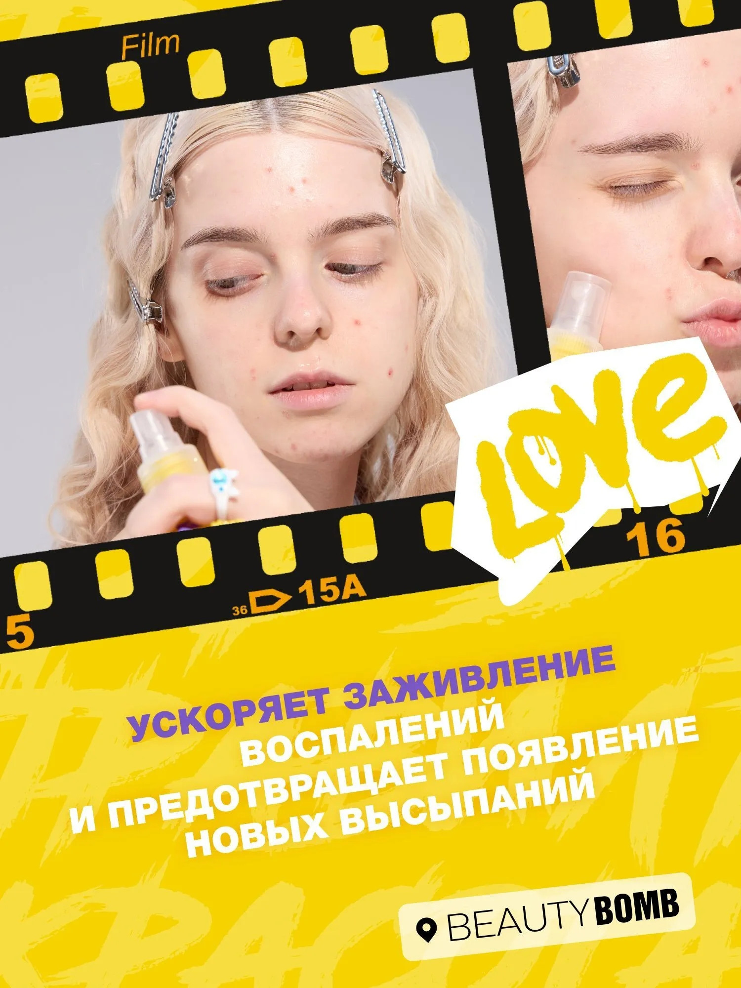 Спрей для лица Beauty Bomb Acne Fighter от прыщей (65мл) — фото 3
