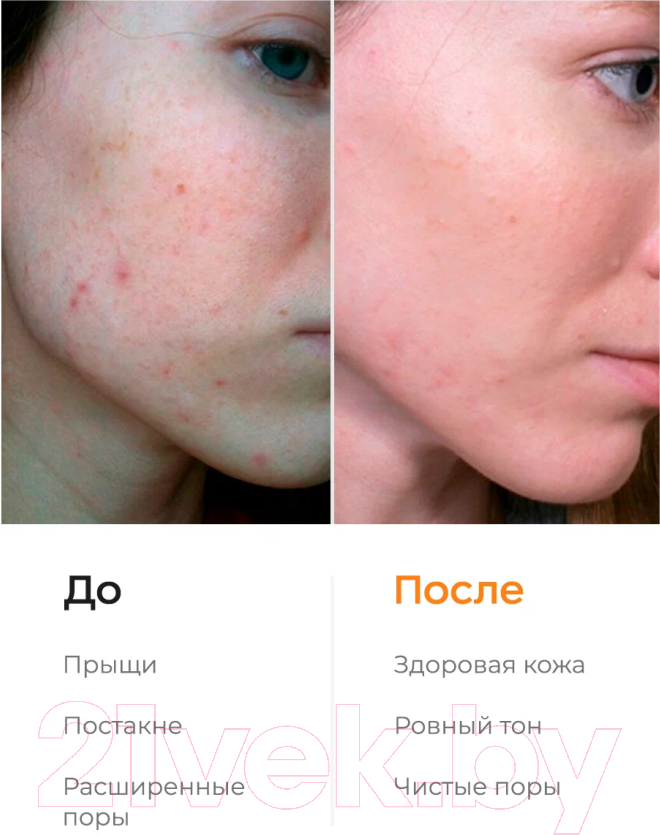 Пудра для умывания Likato Professional Для чувствительной кожи и осветления следов постакне (150мл) — фото 4