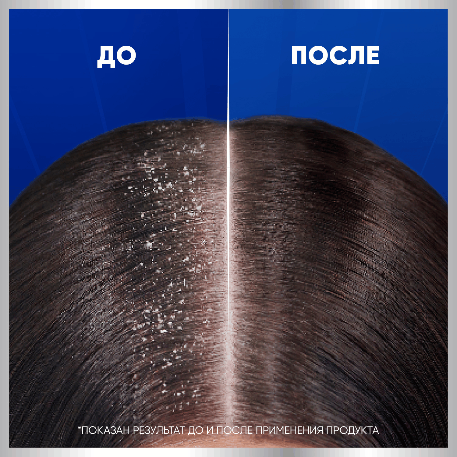Шампунь для волос Head & Shoulders Против выпадения волос 7в1 (300мл) — фото 6