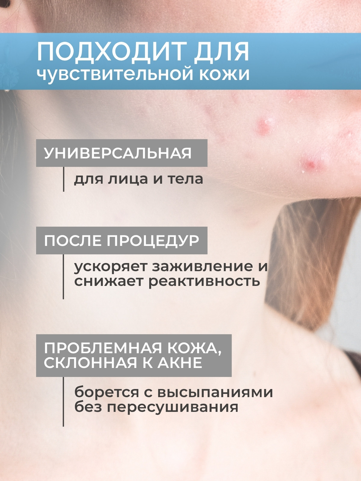 Сыворотка для лица Monmu с ниацинамидом 11% и цинком 1% (30г) — фото 4