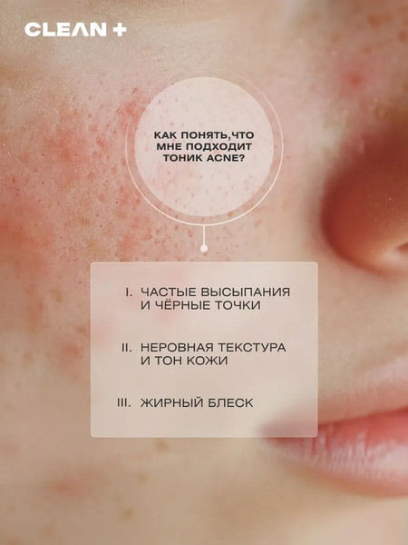 Изображение товара Тоник для лица Clean+ Acne Control (200мл)