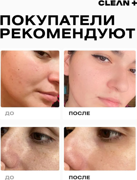 Изображение товара Гель для умывания Clean+ Acne Control (200мл)