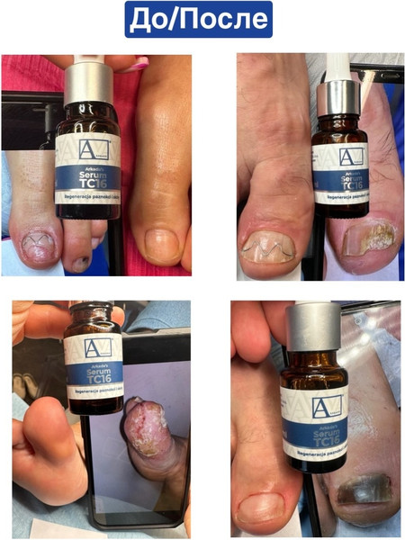 Изображение товара Сыворотка для тела AArkada Serum TC16 регенерирующая (11мл)