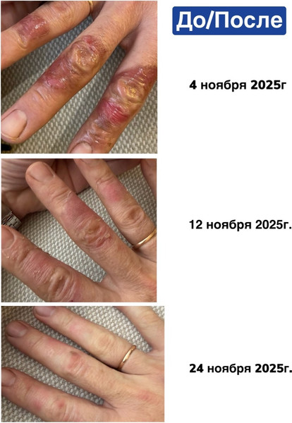 Изображение товара Сыворотка для тела AArkada Serum TC16 регенерирующая (11мл)