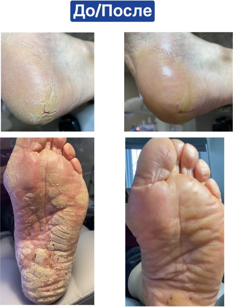 Изображение товара Бальзам для тела AArkada Ointment Глубоко увлажняющая мазь для кожи и ногтей (70мл)