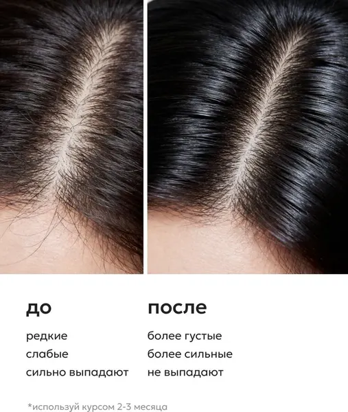 Изображение товара Тоник для волос Likato Professional Против выпадения с женьшенем и красным перцем (150мл)