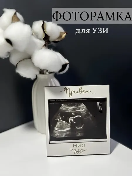 Изображение товара Рамка ОМурМебель для УЗИ Привет, мир