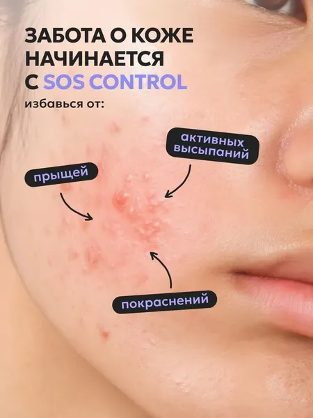 Изображение товара Гель для лица Likato Professional SOS Control Точечный для проблемной кожи (20мл)