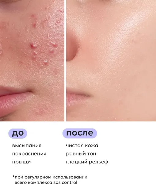 Изображение товара Гель для лица Likato Professional SOS Control Точечный для проблемной кожи (20мл)