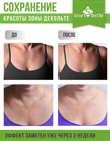 Изображение товара Подушка для зоны декольте Smart Textile Женский каприз. Омоложение 21x18x5 / GKO (бежевый)