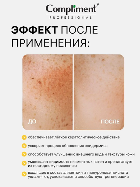 Изображение товара Сыворотка для лица Compliment Professional Kojic Acid с койевой кислотой (27мл)