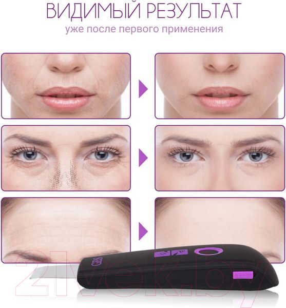 Изображение товара Аппарат для чистки лица Gess You Gess-689