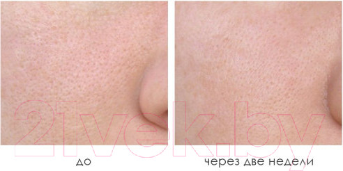 Изображение товара Тоник для лица Eveline Cosmetics Facemed+ отшелушивающий придающий сияние (100мл)