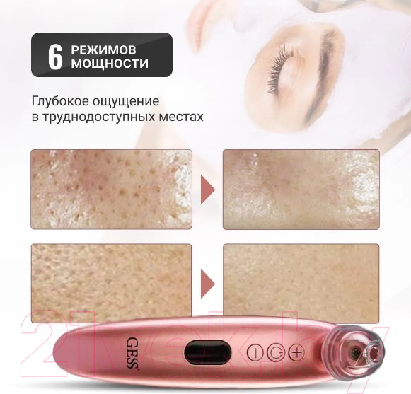 Изображение товара Аппарат для чистки лица Gess GESS-145