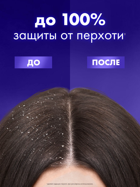 Изображение товара Шампунь для волос Клиар Vita Abe против перхоти для женщин Максимальный объем (400мл)