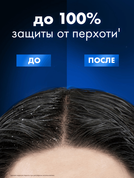 Изображение товара Шампунь для волос Clear Men Vita Abe против перхоти Ледяная свежесть с ментолом (400мл)